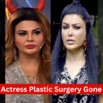 Indian Actress Plastic Surgery Gone Wrong