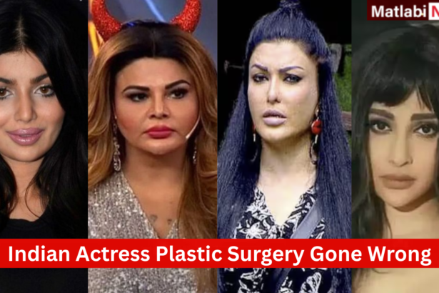 Indian Actress Plastic Surgery Gone Wrong
