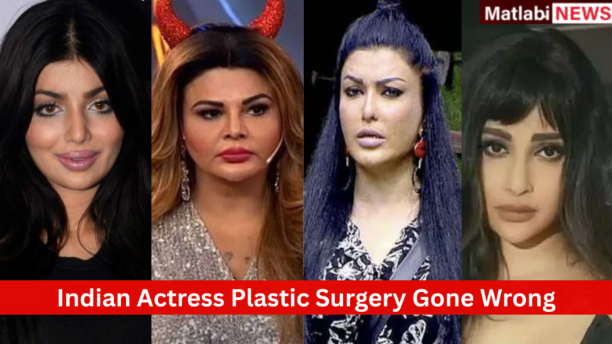 Indian Actress Plastic Surgery Gone Wrong
