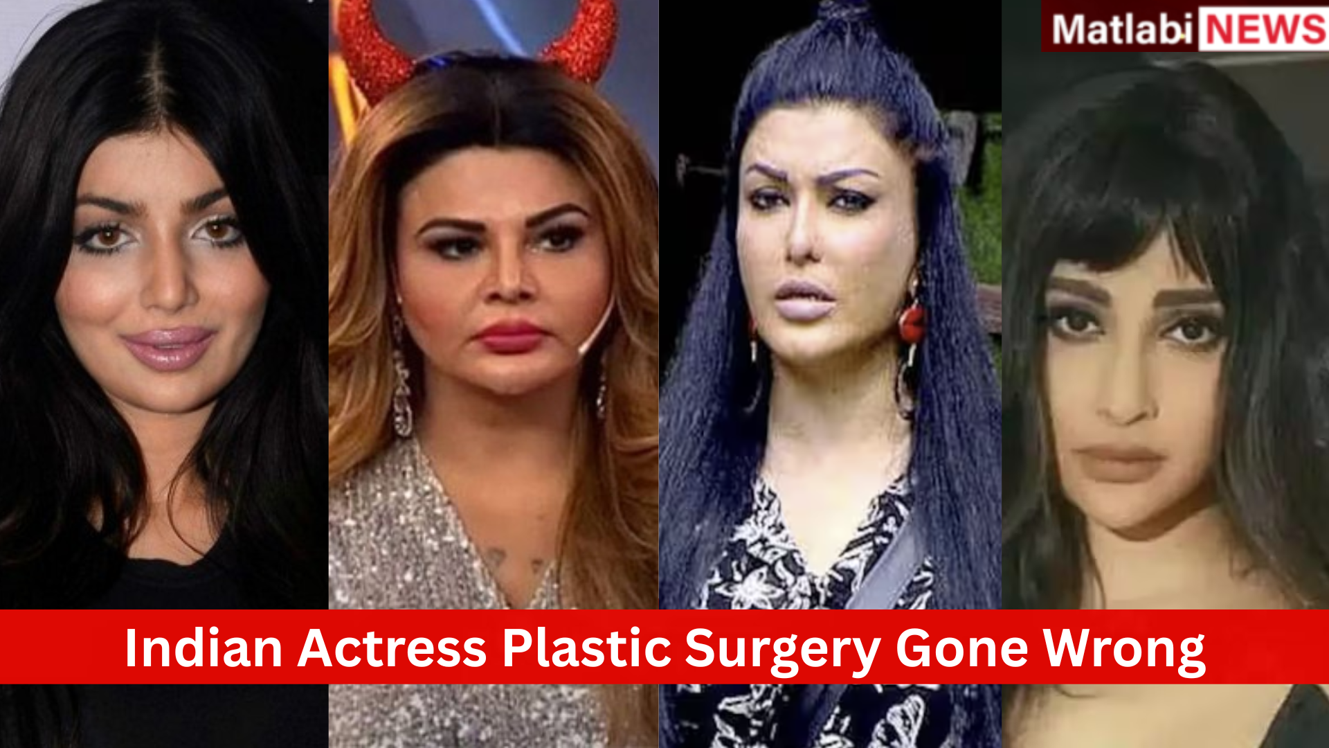 Indian Actress Plastic Surgery Gone Wrong